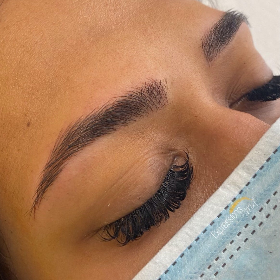 Brow Removal